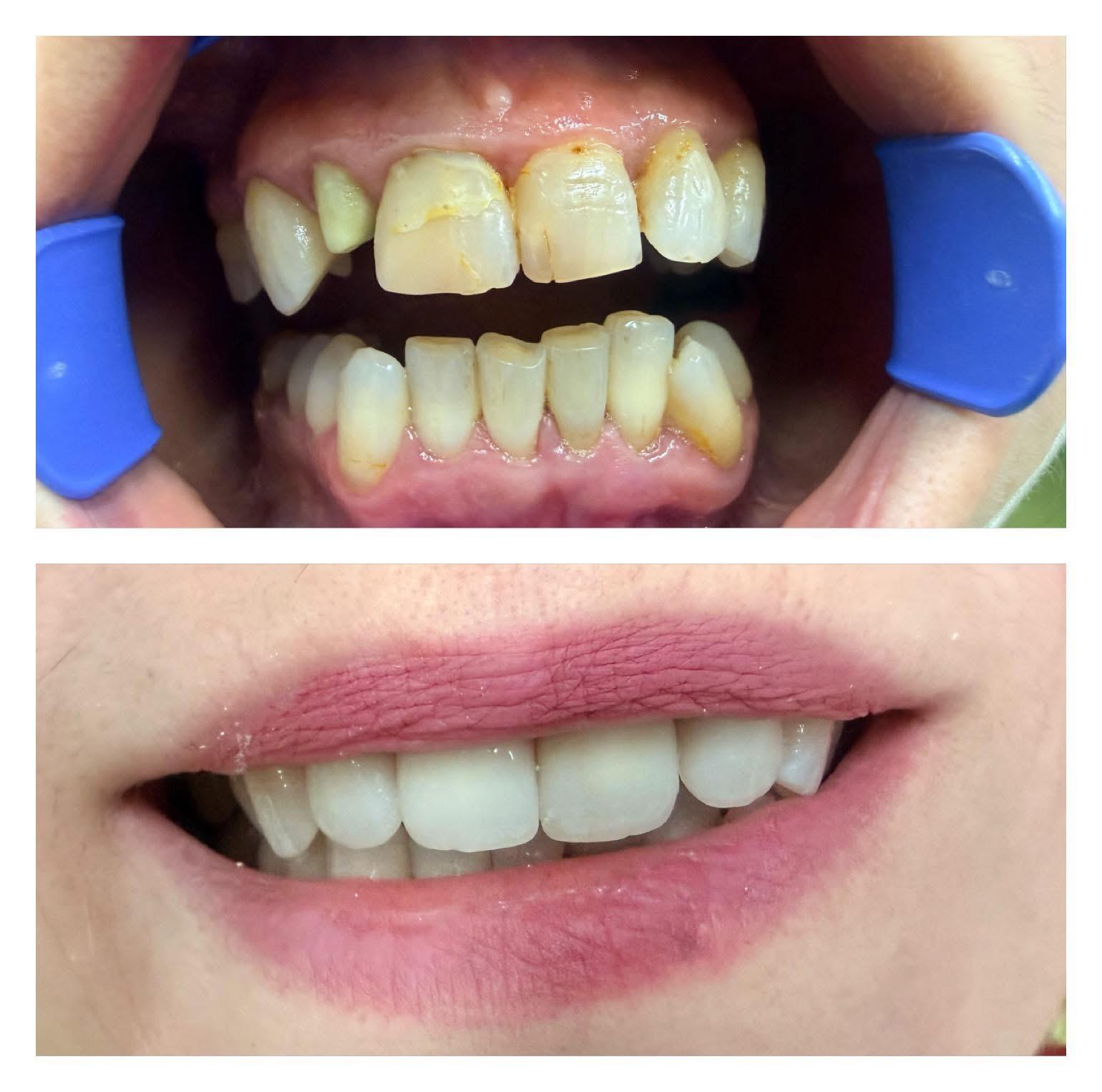 Studiu de caz ortodonție