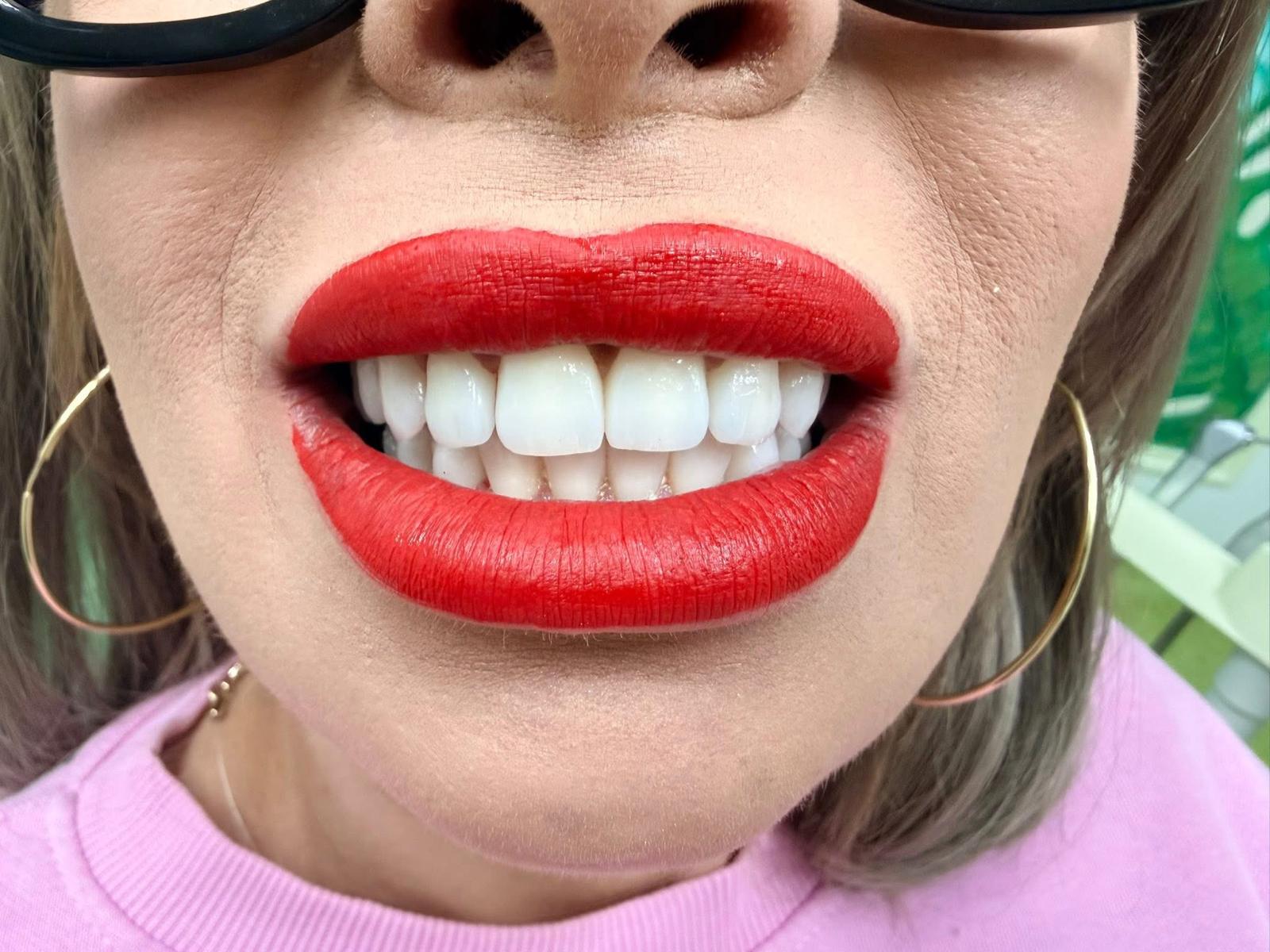 Studiu de caz estetică dentară