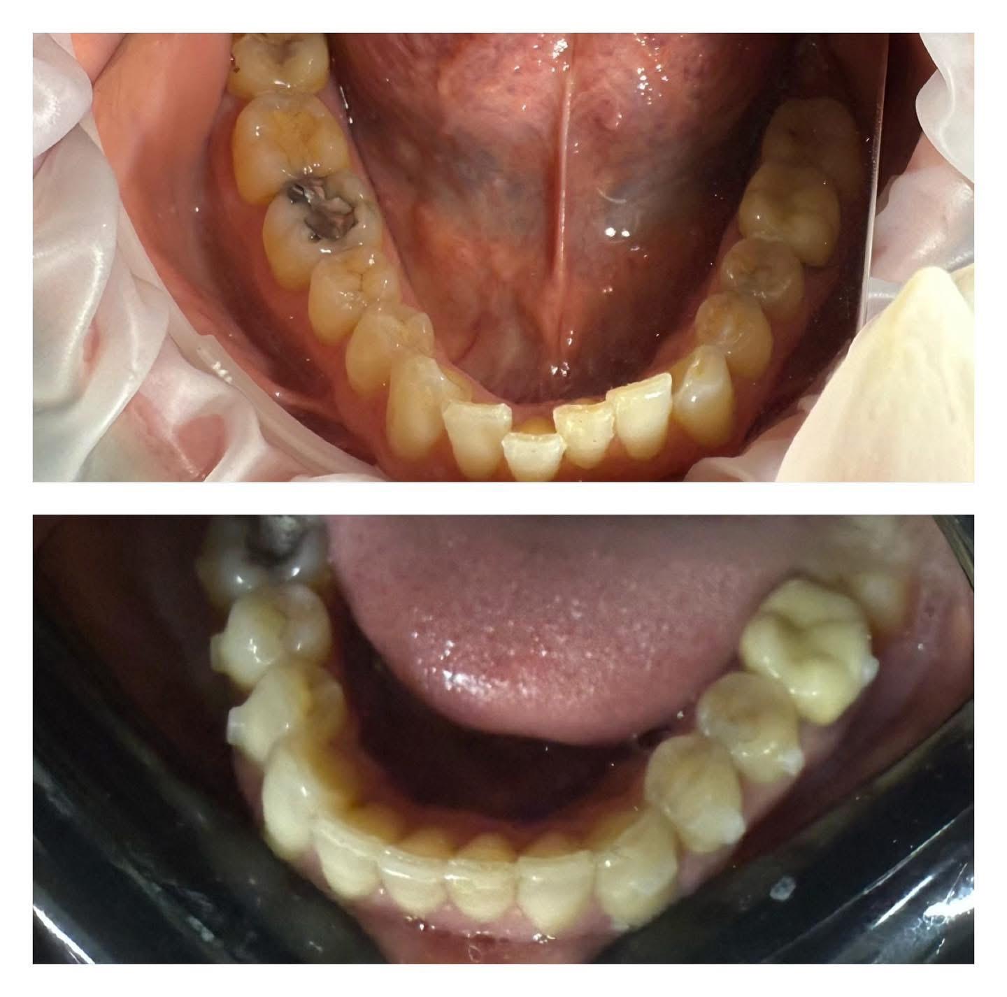Studiu de caz restaurare dentară