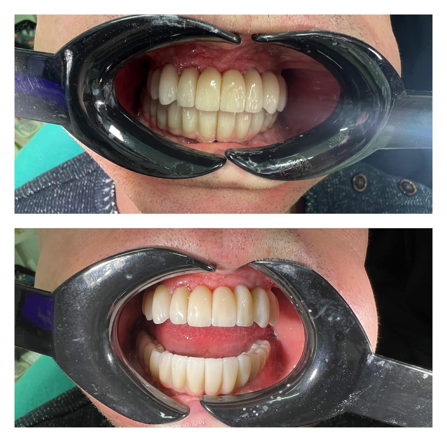 Studiu de caz reabilitare orală completă