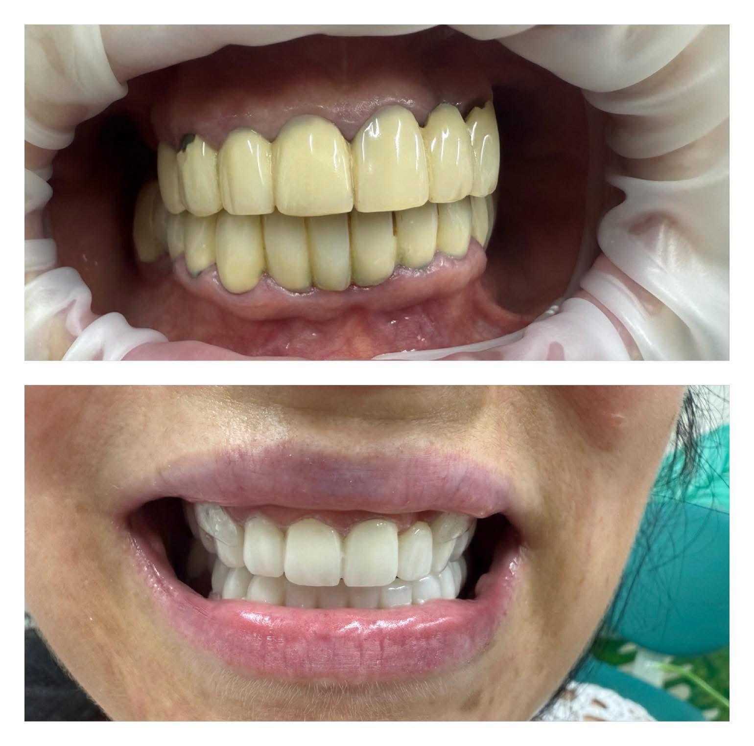 Studiu de caz estetică dentară